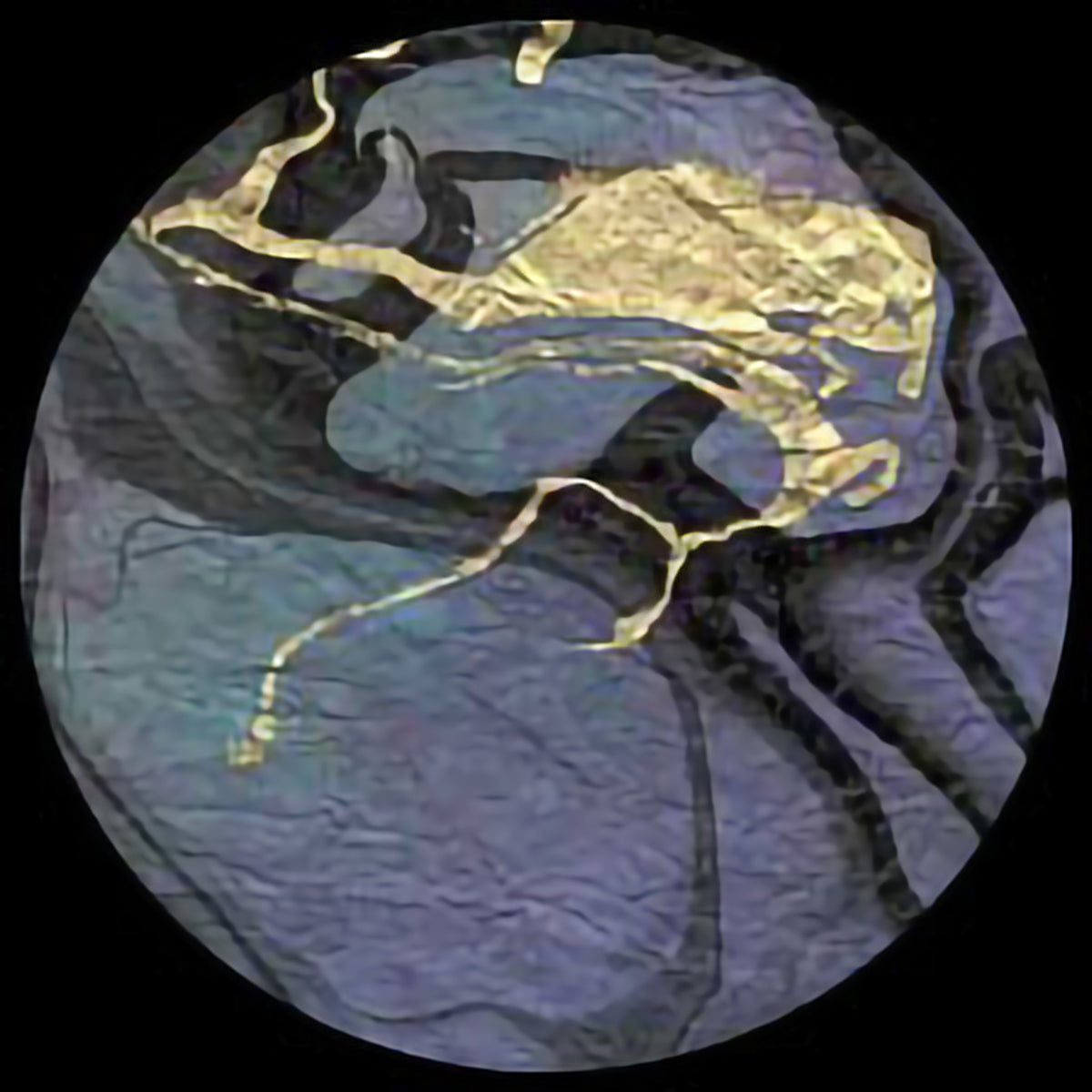 MARBLED MOMI - TSUNAMI